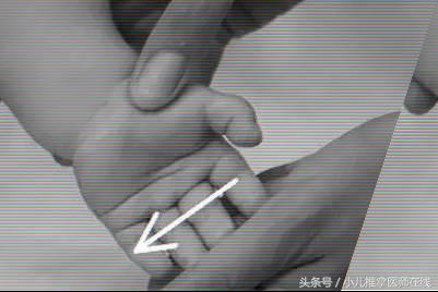 消化不好怎么推拿,宝宝消化不好怎么推拿