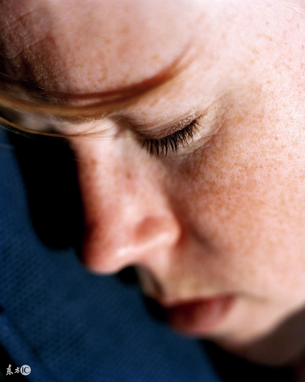 雀斑的形成原因及去除方法,如何避免7岁儿童遗传雀斑