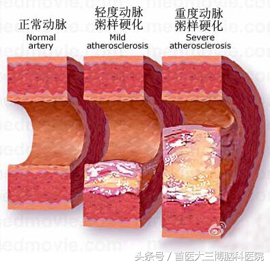 中年人半边身体麻木怎么回事,人到中年眼花