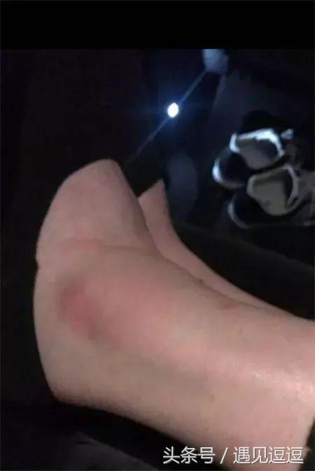 维密大秀奚梦瑶摔跤视频,奚梦瑶维密秀摔跤解读