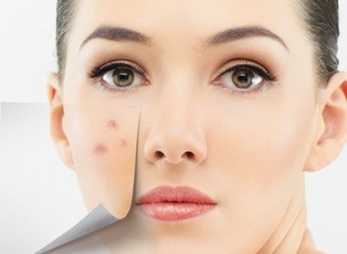 女人外面长什么痘,里面就有什么病!你造吗?