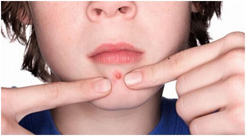 女人外面长什么痘,里面就有什么病!你造吗?