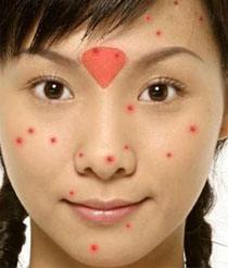 女人外面长什么痘,里面就有什么病!你造吗?