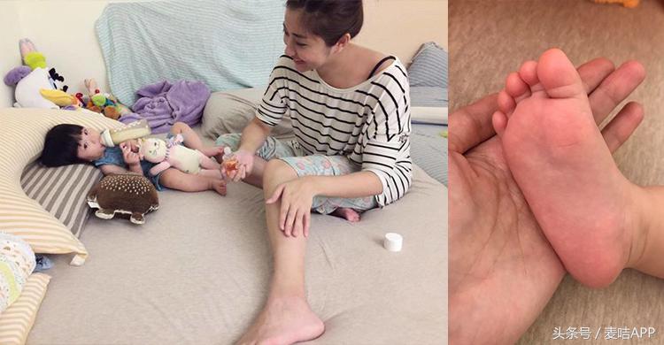 90后妈妈敏感肌护理攻略,冬天换季多效修复凝胶不过敏的方法!