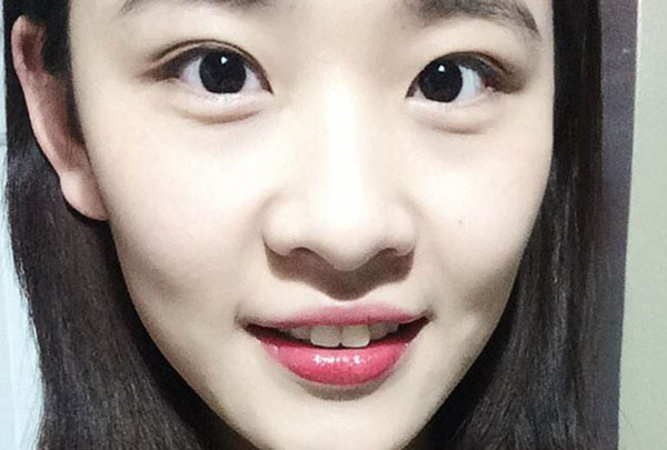 拯救松垮苹果肌，还是护肤术最实在