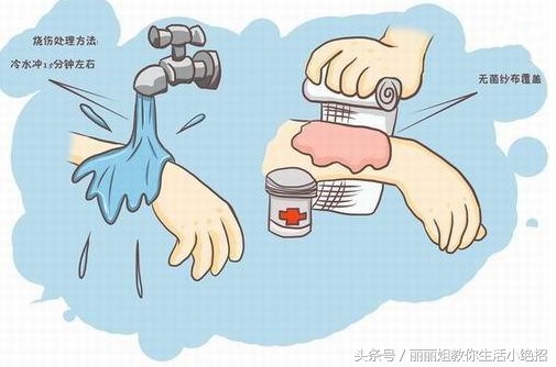 不小心烫伤了要涂什么药,不小心烫伤要怎么样才可以不烫