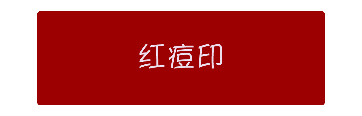 骞垮窞娣″寲鐥樺嵃鐥樺潙姣涘瓟绮楀ぇ,娣″寲鐥樺嵃鐥樺潙姣涘瓟绮楀ぇ鐢风敓