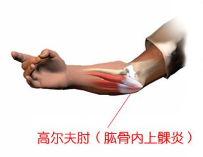 打高尔夫注意哪些事项,高尔夫对身体的伤害