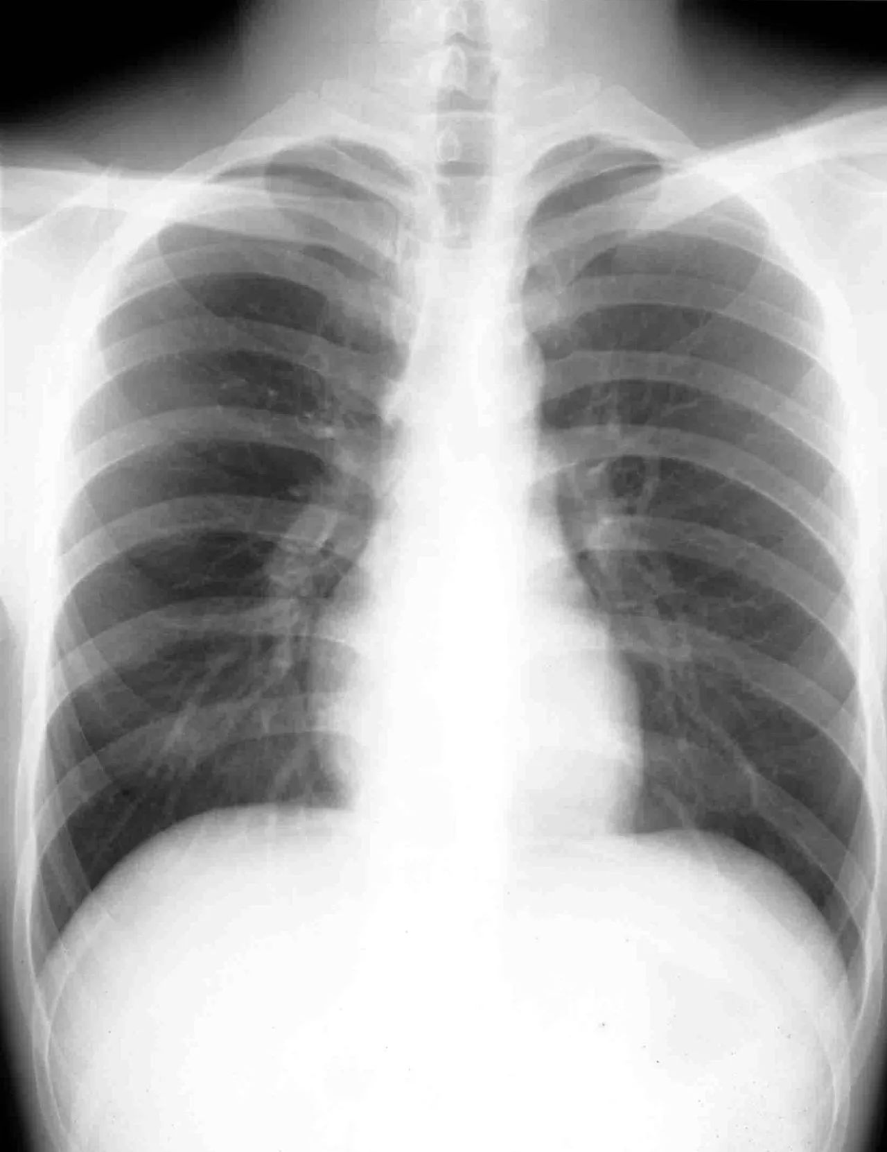 财团到底是什么东西,ct到底对人体有多危害