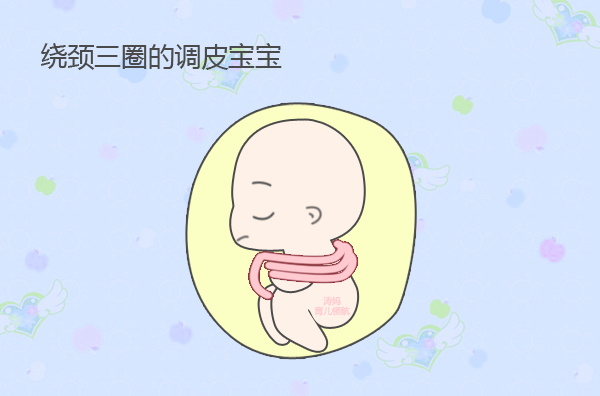 胎儿脐带绕颈一圈需要注意什么,怀孕八个月脐带绕颈3圈怎么办