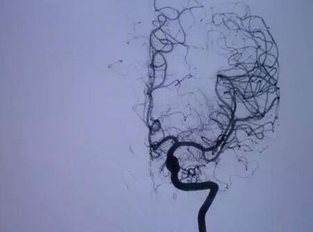 x光ct和核磁共振b超的区别,x光ct磁共振b超有什么区别