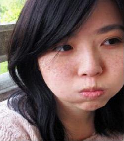 来看看斑点是怎么形成的,16种斑如何分析鉴别