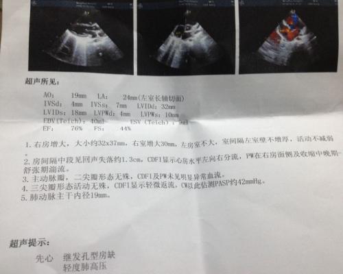 程云阁：患儿房缺1.6mm几岁可以手术？什么情况下可以自愈？