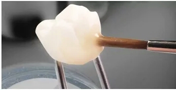 牙松动牙缝过大怎么处理,牙齿补牙缝怎么补