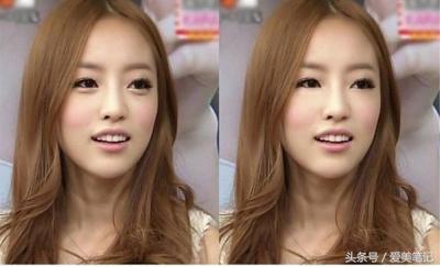 卧蚕和眼袋的区别一眼教你看出,眼袋和卧蚕的区别看完你就知