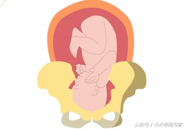 什么是胎儿入盆和开宫口