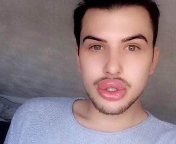 女人为了美丽需要付出多少代价,女人要对自己的美丽负责