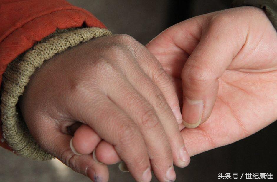 七草缘皮肤教学视频,七草缘中药