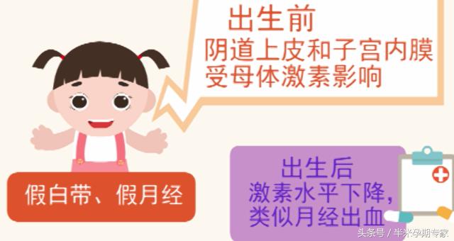 宝宝的假月经、假白带是怎么回事？