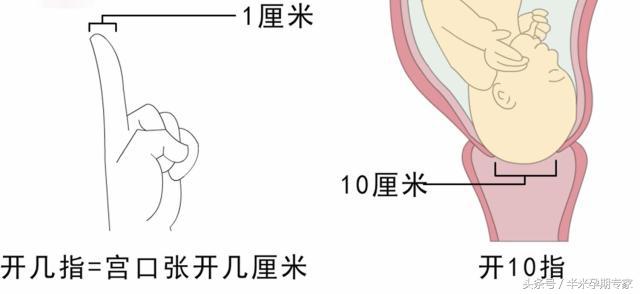 什么是胎儿入盆和开宫口