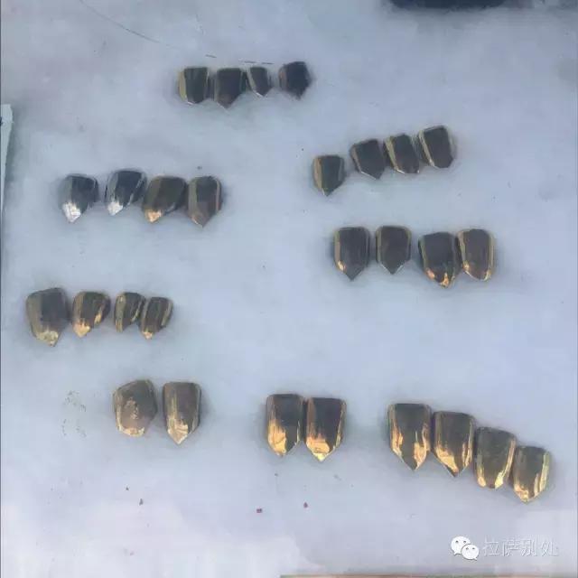 *藏西**往事：八廓街游走牙医，30年前和30年后的故事