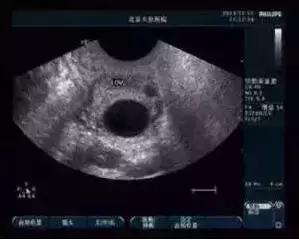 监测排卵也得讲究方法,科普监测排卵的方法