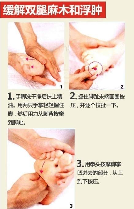 孕期妊娠纹止痒小妙招,按摩哪个穴位可以减轻腿部浮肿