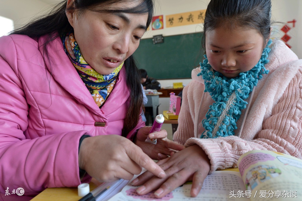 脚上长冻疮了怎么快速处理恢复,脚上冻疮怎么办最有效的方法