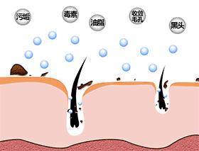 黑头大作战!小窍门彻底跟黑头说ByeBye!(上)
