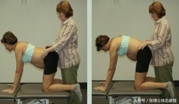 孕期运动操缓解坐骨神经痛,孕期缓解腰背运动操