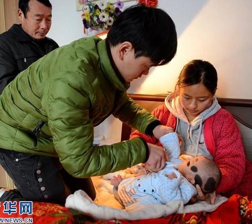 32岁产妇生下怪婴全身长黑毛,孕妇生下七头怪婴