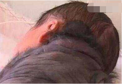 32岁产妇生下怪婴全身长黑毛,孕妇生下七头怪婴