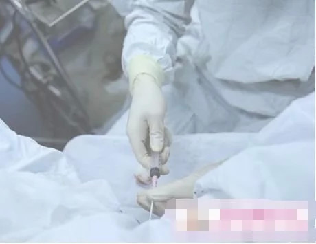 为了老公做试管婴儿值得吗,男人做试管婴儿有多疼