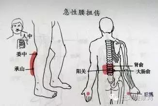 大爷急性腰扭伤推拿,急性腰扭伤多久可以做推拿