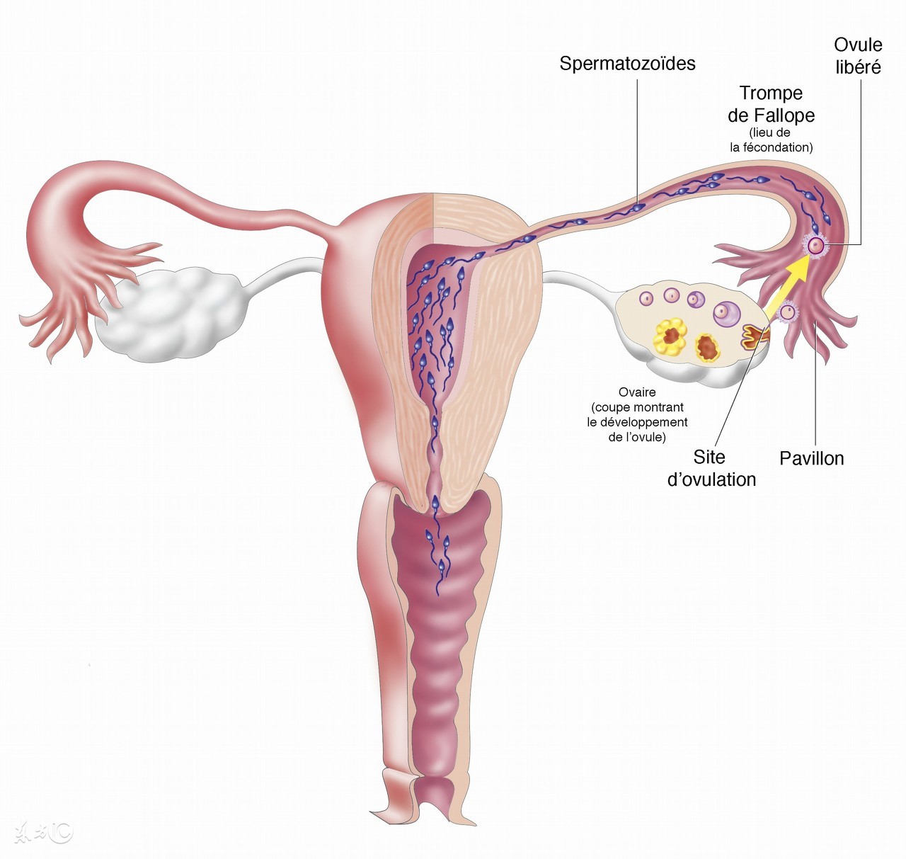输卵管结扎后还有积水影响试管吗,想做试管有输卵管积水怎么办