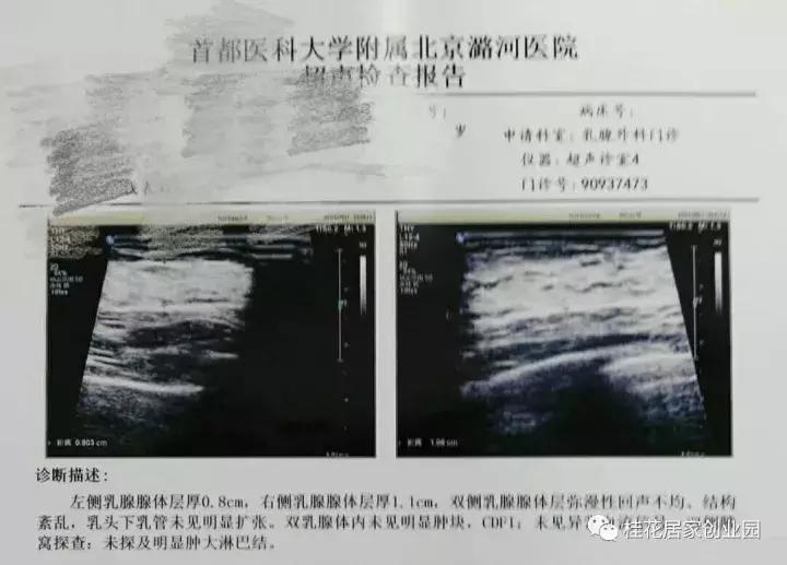 挫折只会让我变得更加强大,所有的挫折都是让你重塑自己