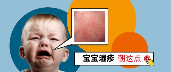 湿疹的相关介绍,湿疹的病因及临床表现转载