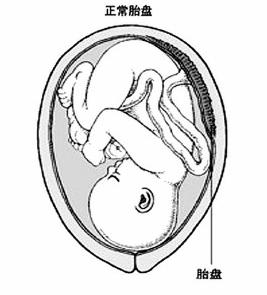 产科夜班之与死神的拉锯之战（上）