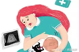 怀孕为啥长子宫肌瘤,年纪轻轻为什么有子宫肌瘤