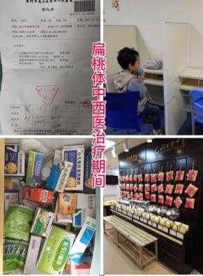 你的扁桃体有什么问题吗,你的扁桃体发炎了么