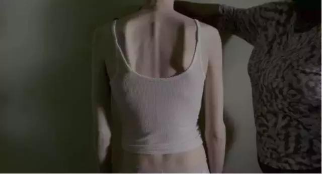 对厌食症人怎么做心理治疗,对厌食症患者怎么心理指导