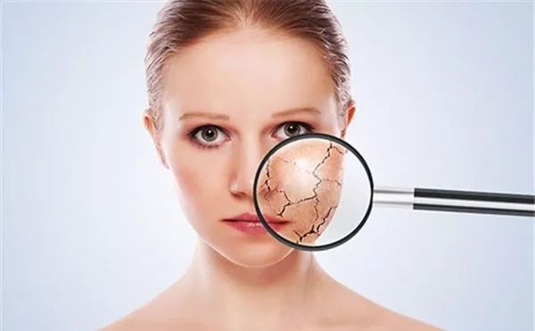 又过敏,又过敏了