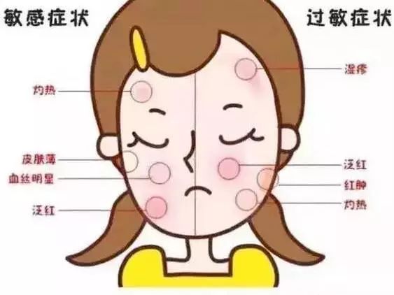 又过敏,又过敏了