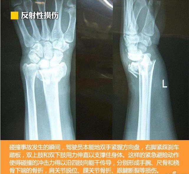 发生车祸时那些人是怎么死的？