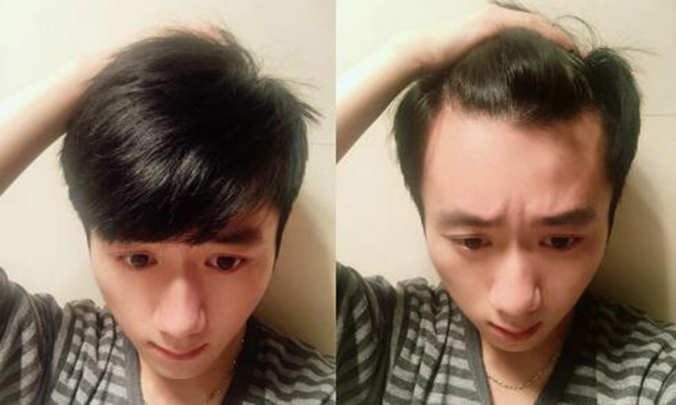 100%去屑止痒洗发水韩国品牌,韩国吕牌洗发水各种颜色功效