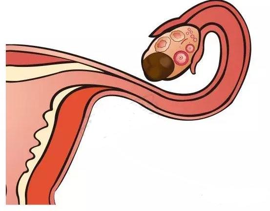 吃巧克力会影响长个子吗,吃巧克力会影响增肌吗