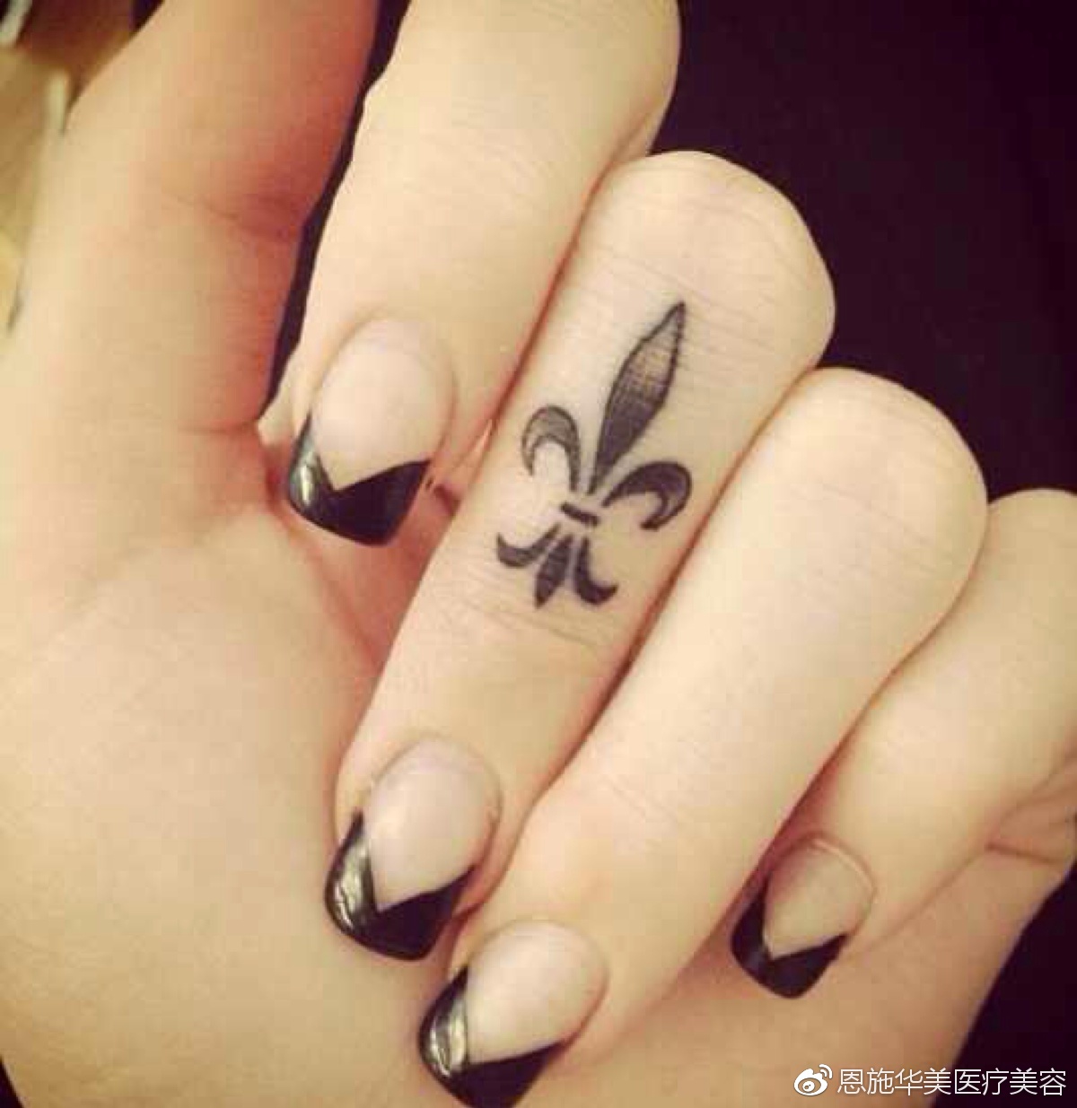 现在的技术洗纹身能洗掉不留疤吗,纹身能彻底洗掉吗会留疤吗