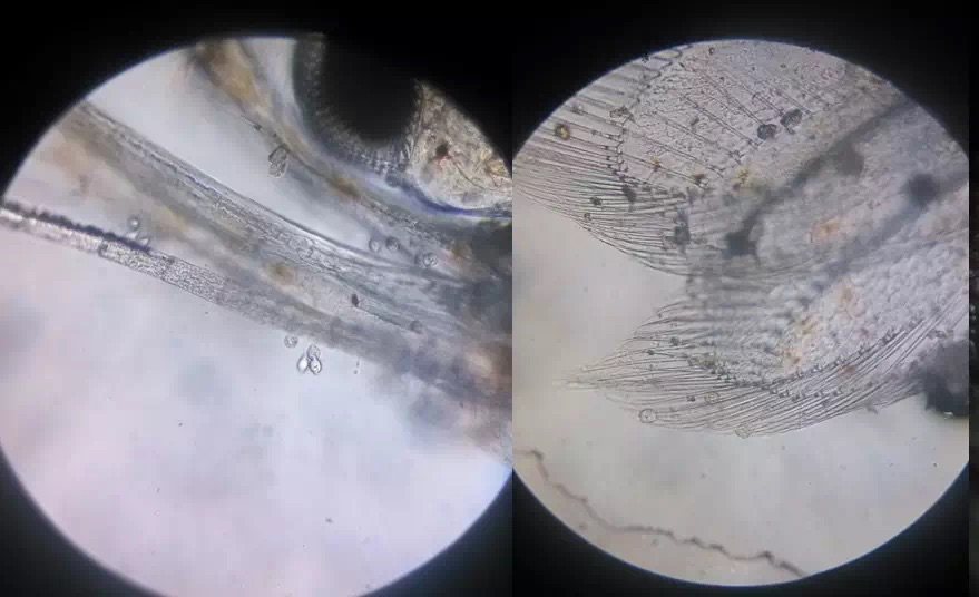 虾田怎么防治纤毛虫,养虾纤毛虫病最佳治疗方法