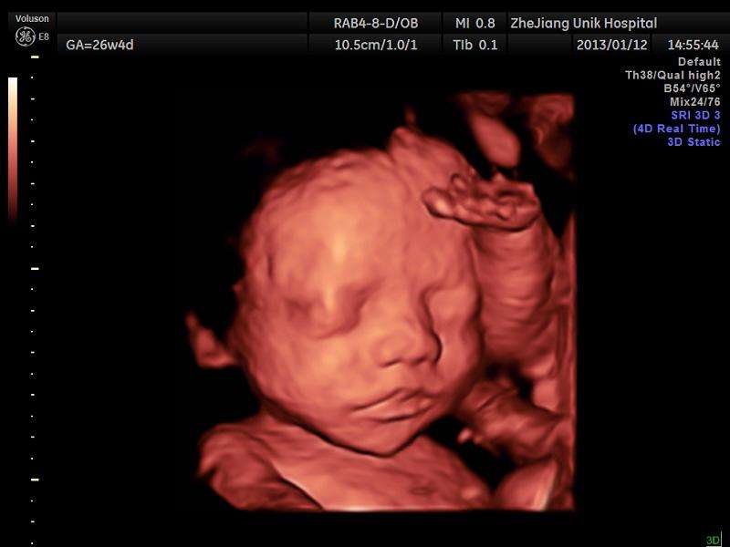 孕妇7个月生气,怀孕后的孕妇能有多不讲理