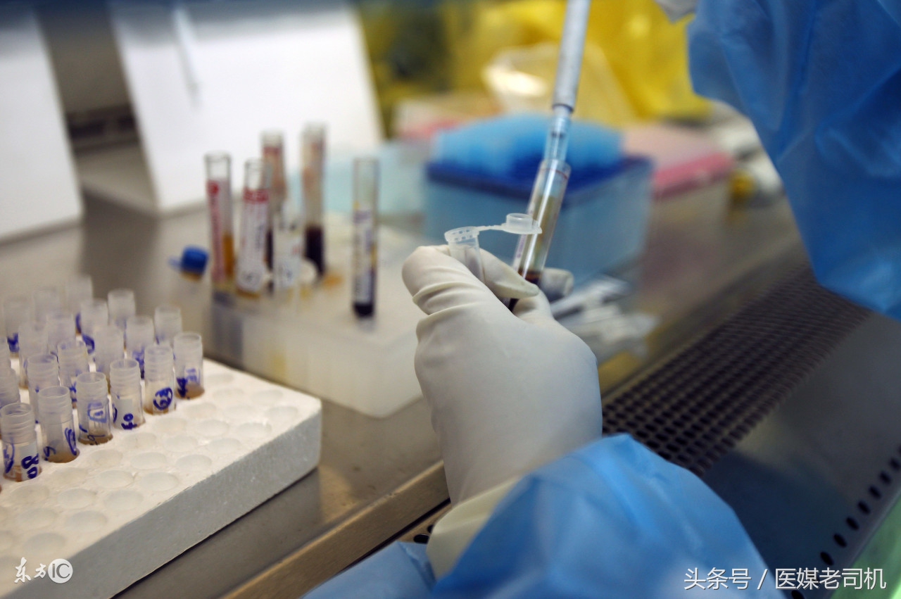 别用噱头制造恐慌!评新京报《协和发现国内首例阴性艾滋病患者》